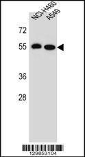 Anti-LRRC6 Rabbit Polyclonal Antibody (AP (Alkaline Phosphatase))