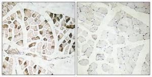 Immunohistochemical analysis of paraffin-embedded human skeletal muscle using Anti-Nogo A Antibody 1:100 (4°C overnight). The right hand panel represents a negative control, where the antibody was pre-incubated with the immunising peptide.