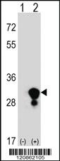 Anti-TPI1 Rabbit Polyclonal Antibody