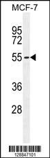 Anti-PMPCA Rabbit Polyclonal Antibody