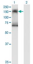 Anti-SIK2 Mouse Monoclonal Antibody [clone: 4H6]