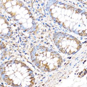 Immunohistochemistry analysis of paraffin-embedded human colon tissue using Anti-MT4-MMP Antibody (A9132) at a dilution of 1:100 (40X lens). Perform microwave antigen retrieval with 10 mM PBS buffer pH 7.2 before commencing with IHC staining protocol