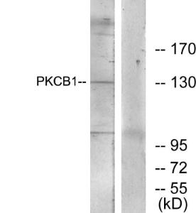 Western blot analysis of lysates from 293 cells using Anti-PKCB1 Antibody. The right hand lane represents a negative control, where the Antibody is blocked by the immunising peptide