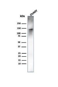 Western blot analysis of human ovary tissue lysate using Anti-Caldesmon Antibody [rCALD1/820]