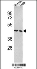 Anti-TUFM Rabbit Polyclonal Antibody