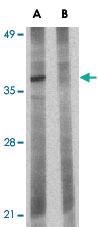 Anti-BCL2L10 Rabbit Polyclonal Antibody