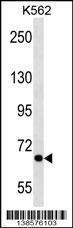 Anti-CARF Rabbit Polyclonal Antibody (HRP (Horseradish Peroxidase))