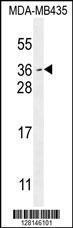 Anti-MYCT1 Rabbit Polyclonal Antibody (Biotin)