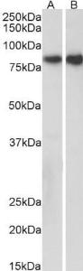 Anti-E Cadherin Goat Polyclonal Antibody