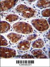 Anti-OR2F2 Rabbit Polyclonal Antibody [clone: 156CT27.1.5]