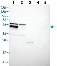 Anti-WIPF2 Rabbit Polyclonal Antibody