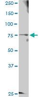 Anti-GTSE1 Rabbit Polyclonal Antibody