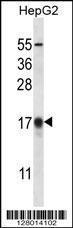 Anti-MAP1LC3B Rabbit Polyclonal Antibody (Biotin)