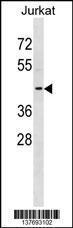 Anti-KCNAB3 Rabbit Polyclonal Antibody