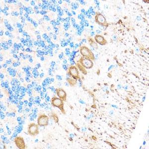 Immunohistochemistry analysis of paraffin-embedded mouse brain using Anti-MT4-MMP Antibody (A9132) at a dilution of 1:100 (40X lens). Perform microwave antigen retrieval with 10 mM PBS buffer pH 7.2 before commencing with IHC staining protocol