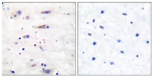 Immunohistochemical analysis of paraffin-embedded human brain tissue using Anti-NMDAR1 Antibody. The right hand panel represents a negative control, where the antibody was pre-incubated with the immunising peptide