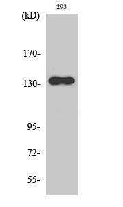 Western blot analysis of various cells using Anti-PKCB1 Antibody