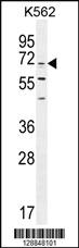 Anti-CPSF3L Rabbit Polyclonal Antibody