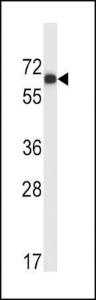 Anti-MATK Rabbit Polyclonal Antibody (PE (Phycoerythrin))