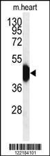 Anti-HFE2 Rabbit Polyclonal Antibody (AP (Alkaline Phosphatase))