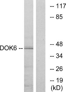 Western blot analysis of lysates from COLO cells using Anti-DOK6 Antibody. The right hand lane represents a negative control, where the antibody is blocked by the immunising peptide