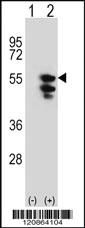 Anti-TUFM Rabbit Polyclonal Antibody