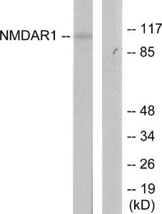 Western blot analysis of lysates from Jurkat cells using Anti-NMDAR1 Antibody. The right hand lane represents a negative control, where the antibody is blocked by the immunising peptide