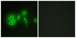 Antibody anti-ADCY8 100 µg