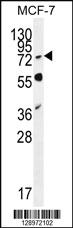 Anti-RNF19B Rabbit Polyclonal Antibody