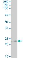 Anti-RPL17 Goat Polyclonal Antibody