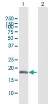 Anti-VIMP Rabbit Polyclonal Antibody