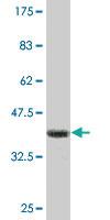 Anti-YBX3 Mouse Monoclonal Antibody [clone: 1H5]