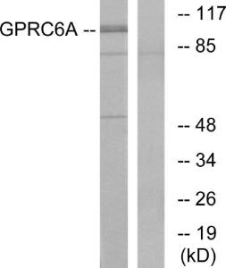 Western blot analysis of lysates from Jurkat cells using Anti-GPRC6A Antibody. The right hand lane represents a negative control, where the antibody is blocked by the immunising peptide