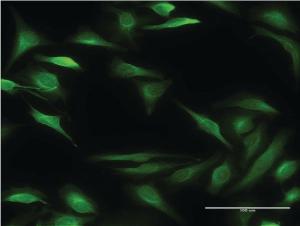 Anti-ALOX15B Mouse Monoclonal Antibody [clone: 4A7]