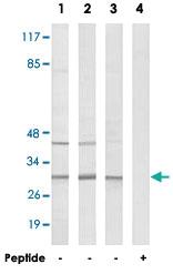 Anti-RPS4Y1 Rabbit Polyclonal Antibody