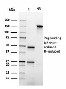 SDS-PAGE analysis of Anti-Apolipoprotein A1 Antibody [APOA1/3661] under non-reduced and reduced conditions; showing intact IgG and intact heavy and light chains, respectively. SDS-PAGE analysis confirms the integrity and purity of the antibody