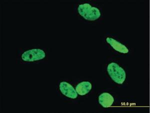 Anti-RUNX2 Mouse Monoclonal Antibody [clone: 2B9]