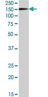 Anti-SENP6 Goat Polyclonal Antibody