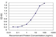 Anti-SRPK1 Mouse Monoclonal Antibody [clone: 2E8]