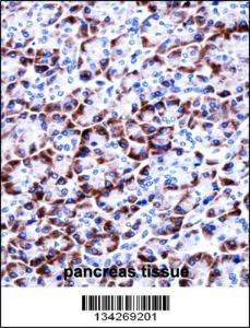 Anti-CCDC50 Rabbit Polyclonal Antibody