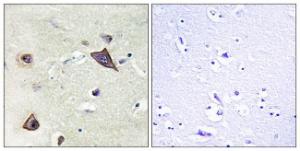 Immunohistochemical analysis of paraffin-embedded human brain tissue using Anti-NMDAR1 Antibody. The right hand panel represents a negative control, where the antibody was pre-incubated with the immunising peptide