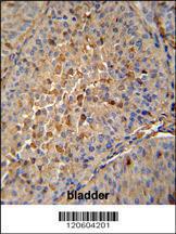 Anti-MAPRE1 Rabbit Polyclonal Antibody (Biotin)