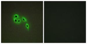 Immunofluorescence analysis of A549 cells using Anti-DOK6 Antibody. The right hand panel represents a negative control, where the antibody was pre-incubated with the immunising peptide