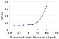 Anti-ALOX15B Mouse Monoclonal Antibody [clone: 4A7]