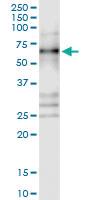 Anti-YBX3 Polyclonal Antibody Pair