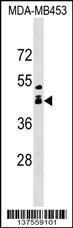 Anti-ALX1 Rabbit Polyclonal Antibody (APC (Allophycocyanin))