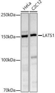 Western blot analysis of extracts of various cell lines, using Anti-LATS1/WARTS Antibody (A93250) at 1:1000 dilution. The secondary Antibody was Goat Anti-Rabbit IgG H&L Antibody (HRP) at 1:10000 dilution. Lysates/proteins were present at 25 µg per lane