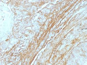 Anti-Tenascin C Mouse Monoclonal Antibody [clone: T2H5]