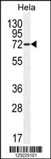 Anti-ATG7 Rabbit Polyclonal Antibody