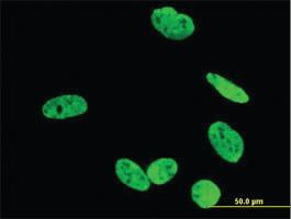 Anti-RUNX2 Mouse Monoclonal Antibody [clone: 2B9]